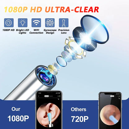 Visual Ear Cleaner with Camera – HD Otoscope Ear Wax Removal Tool with LED Light